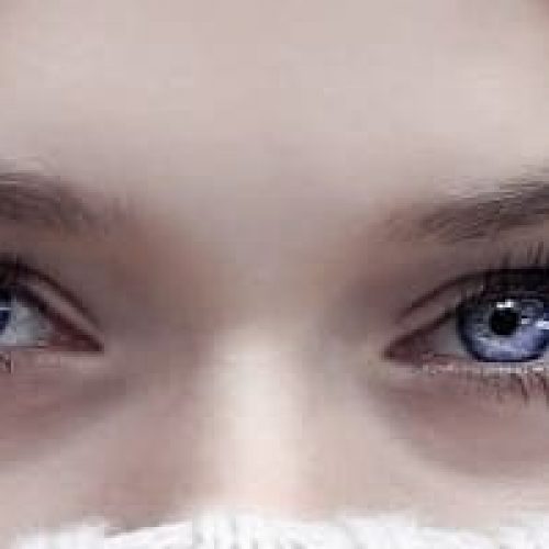 Hva er sfæriske kontaktlinser?