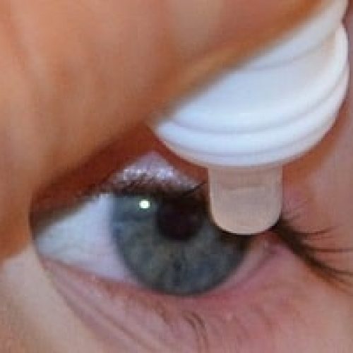 Hvordan unngå tørre øyne ved bruk av kontaktlinser?